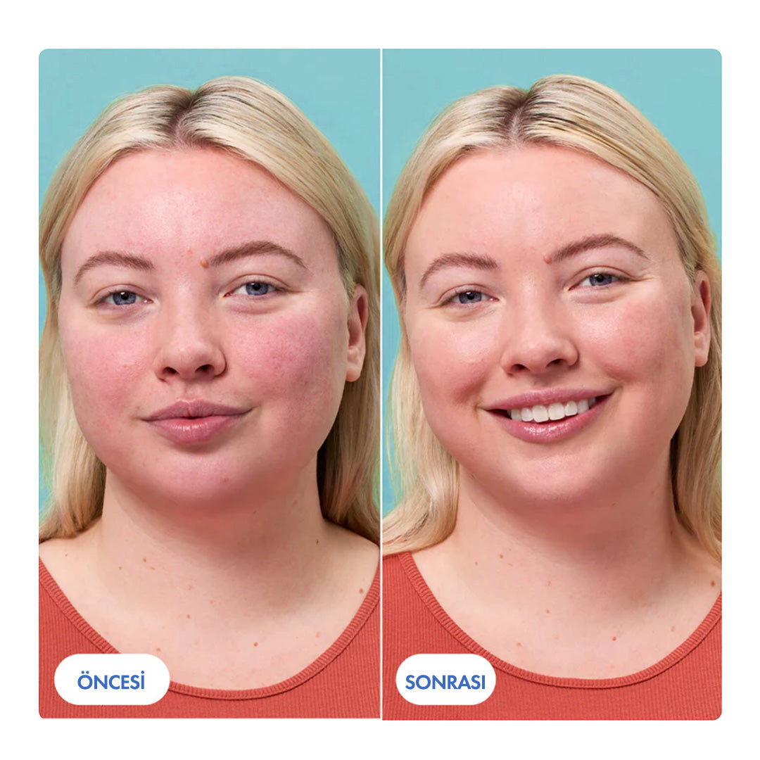 Anti-Redness Kızarıklık Karşıtı Serum