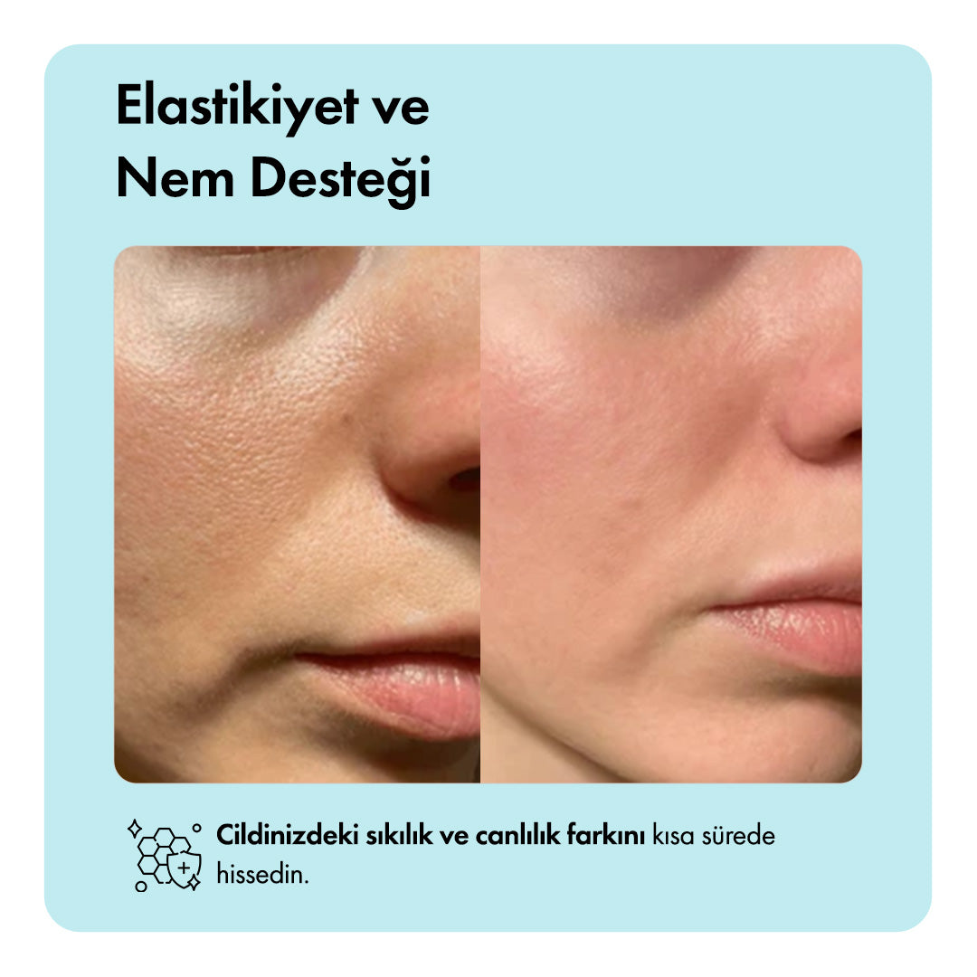 Zero Pore™ Temizleme Barı