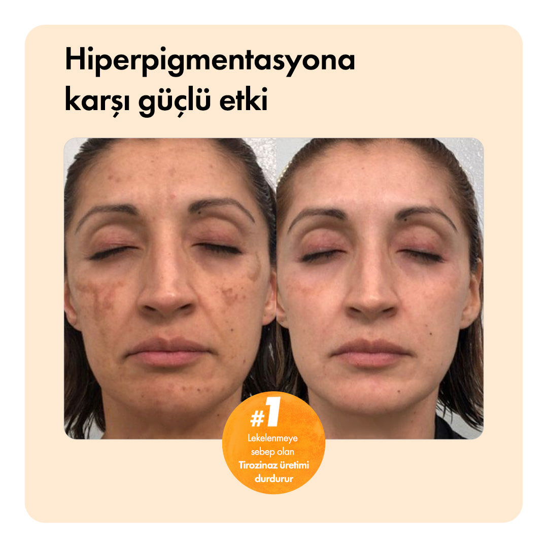 Kojiso™ Temizleme Barı ys-kojiso-cod