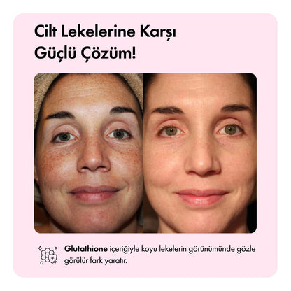 Light Up™ Aydınlatıcı Serum