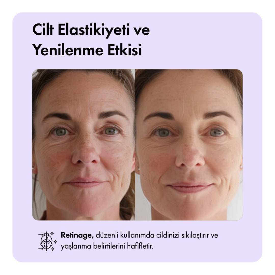 Retinage™ Temizleme Barı