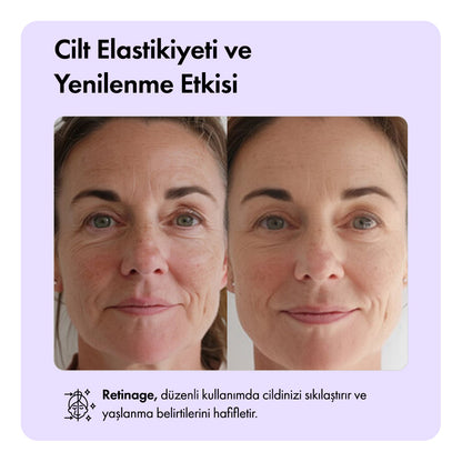 Retinage™ Temizleme Barı