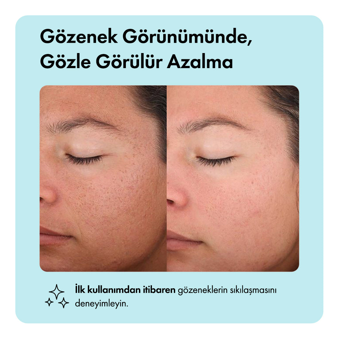 Zero Pore™ Temizleme Barı