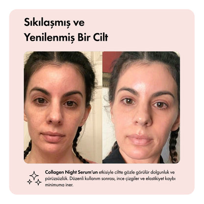 Collagen Night™  Cilt Yenileyici Serum