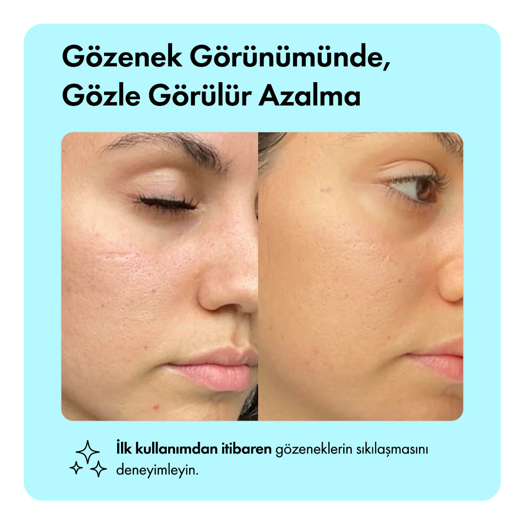 Zero Pore™ Gözenek Sıkılaştırıcı Serum