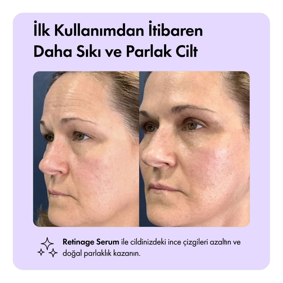 Retinage™ Serum