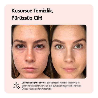 Collagen Night™  Barı