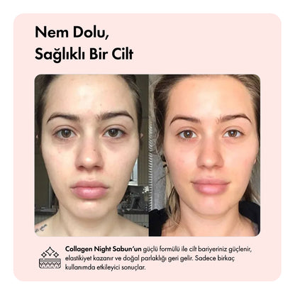 Collagen Night™  Barı