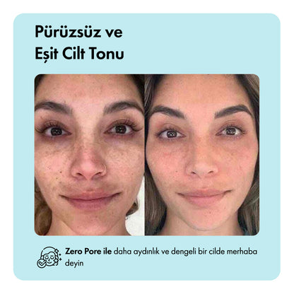 Zero Pore™ Temizleme Barı