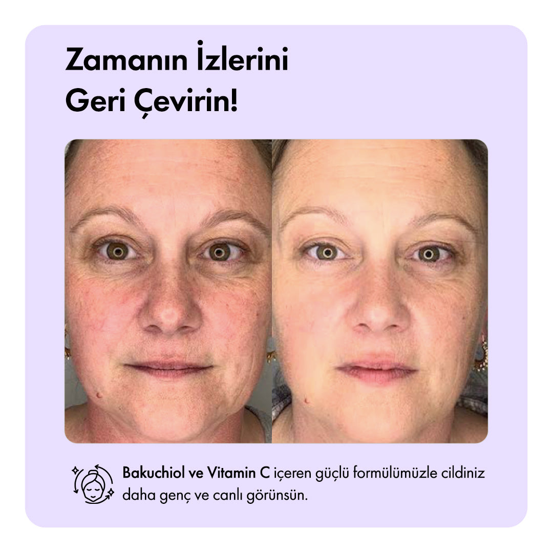 Retinage™ Temizleme Barı