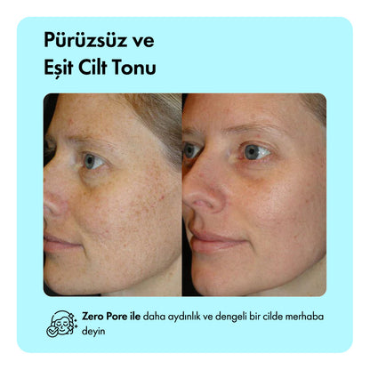 Zero Pore™ Gözenek Sıkılaştırıcı Serum