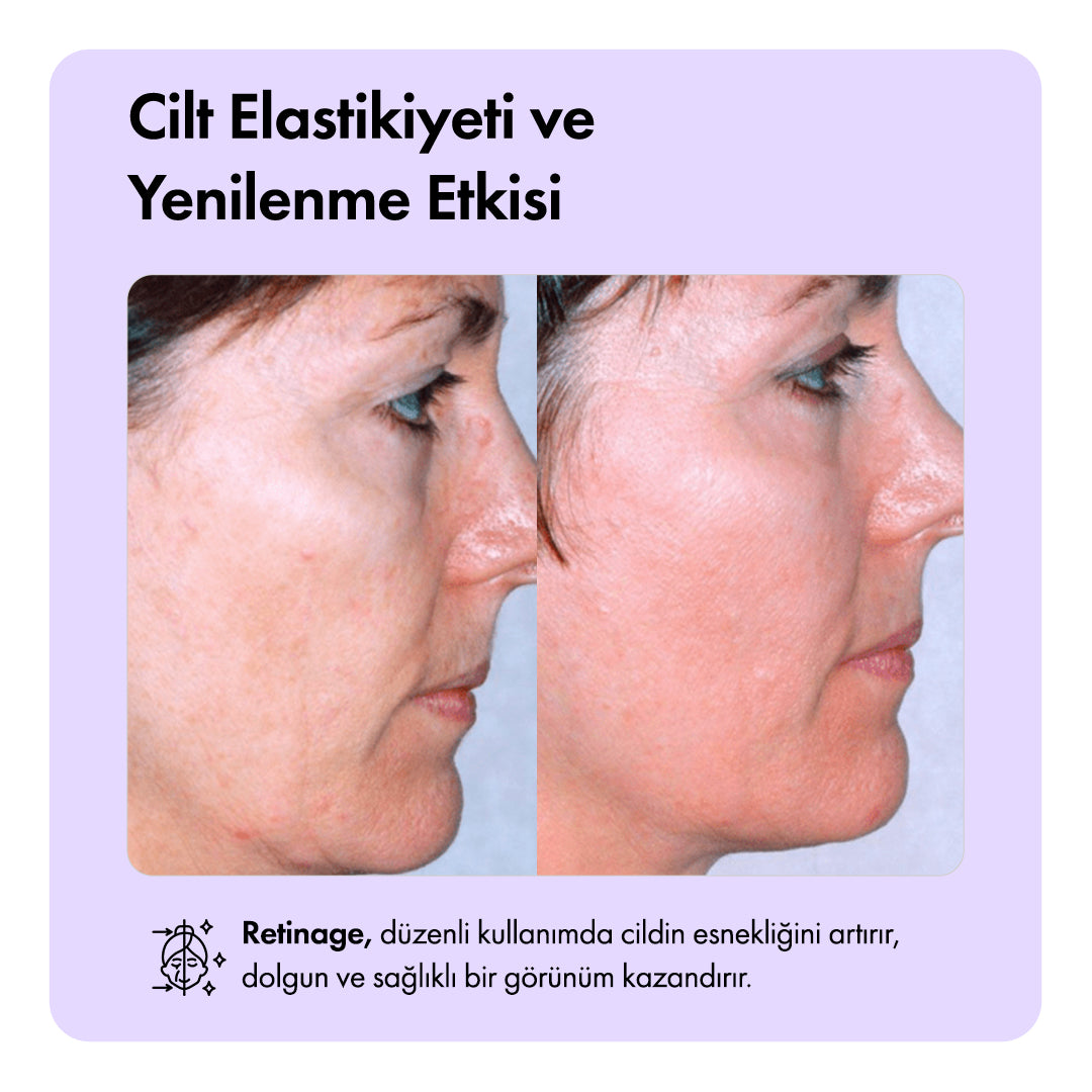 Retinage™ Serum